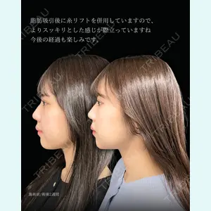 症例