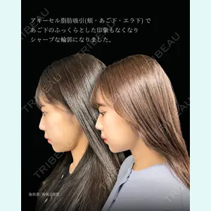症例