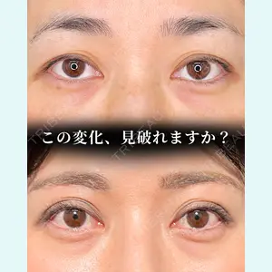 症例
