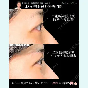 症例