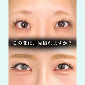 症例