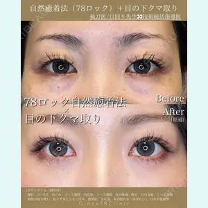 Ginza 78 Clinicの症例