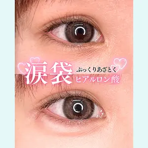 症例