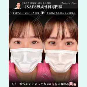 症例