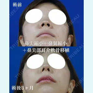 リッツ美容外科 大阪院の症例