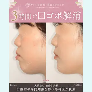 カトレア歯科・美容クリニック 辻 和志医師の症例