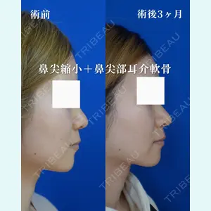 リッツ美容外科 大阪院の症例