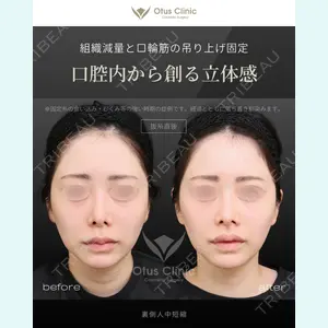 症例