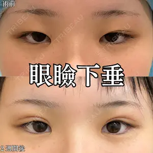 形成外科と美容外科のクリニック池袋 春日 航医師の症例