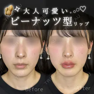 ルラ美容クリニック 大宮院 右京 大季医師の症例