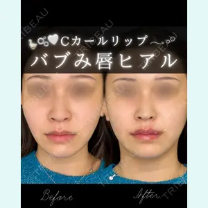 ルラ美容クリニック 大宮院 右京 大季医師の症例