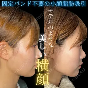 症例