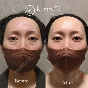 Kuma CLI 【クマクリ】 毛利 理人医師の症例