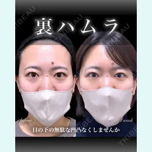 EMMO FACE CLINIC 大宮院 百瀬 直也医師の症例