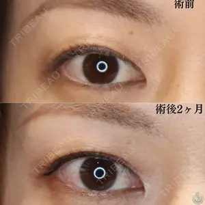 症例