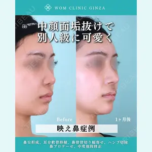 WOM CLINIC GINZA （ワム クリニック ギンザ） 中井 孝昌医師の症例