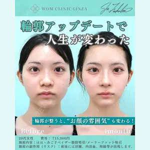WOM CLINIC GINZA （ワム クリニック ギンザ） 深堀 純也医師の症例