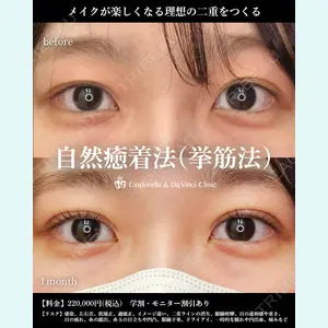 シンデレラ＆ダヴィンチクリニック 宮田 洋佑医師の症例