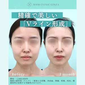 WOM CLINIC GINZA （ワム クリニック ギンザ） 佐々木 和司医師の症例
