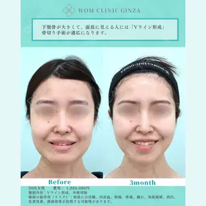 WOM CLINIC GINZA （ワム クリニック ギンザ） 佐々木 和司医師の症例