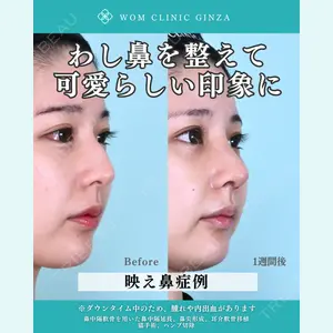 WOM CLINIC GINZA （ワム クリニック ギンザ） 中井 孝昌医師の症例