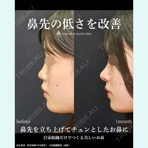 シンデレラ＆ダヴィンチクリニック 宮田 洋佑医師の症例