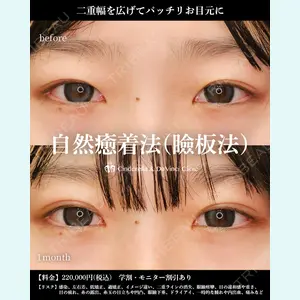 シンデレラ＆ダヴィンチクリニック 宮田 洋佑医師の症例