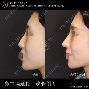 聖心美容クリニック 六本木院 川端 優也医師の症例