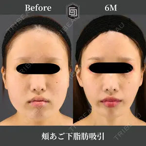 Casa de GRACIA GINZA 【カーサデグラシアギンザ】 吉田 直樹医師の症例