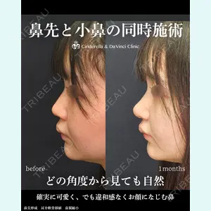 シンデレラ＆ダヴィンチクリニック 宮田 洋佑医師の症例