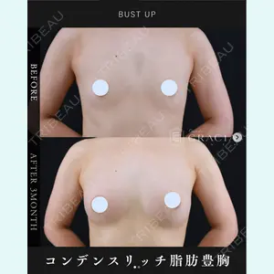 症例