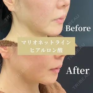 CHARIS BEAUTY CLINICの症例