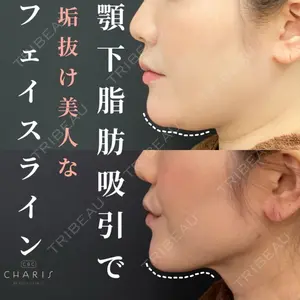 CHARIS BEAUTY CLINICの症例
