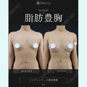 症例