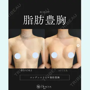 症例