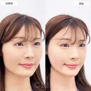 A CLINIC（エークリニック） 仙台院 伊藤 瑠桂医師の症例