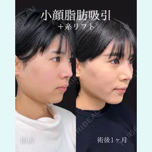 症例