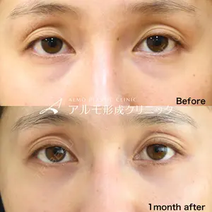 アルモ形成クリニックの症例