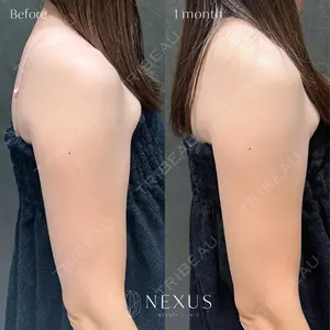 NEXUS CLINICの症例