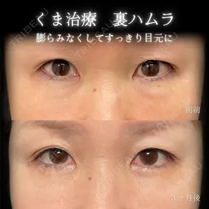 eクリニック 大阪院 脇谷 雄一朗医師の症例