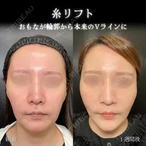 eクリニック 大阪院 脇谷 雄一朗医師の症例