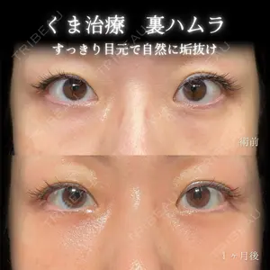 eクリニック 大阪院 脇谷 雄一朗医師の症例