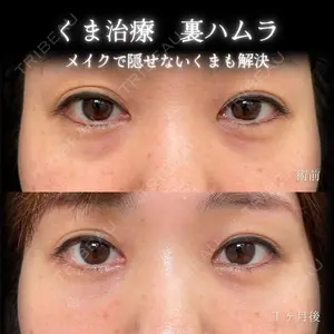 eクリニック 大阪院 脇谷 雄一朗医師の症例