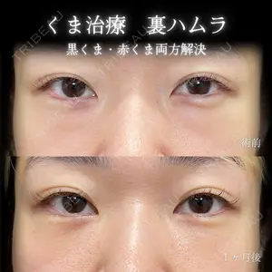 eクリニック 大阪院 脇谷 雄一朗医師の症例