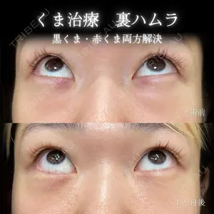 eクリニック 大阪院 脇谷 雄一朗医師の症例