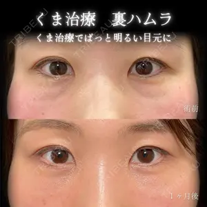 eクリニック 大阪院 脇谷 雄一朗医師の症例
