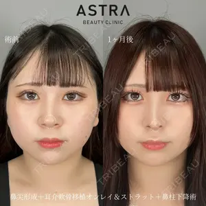 ASTRA BEAUTY CLINIC 塩満 惠子医師の症例