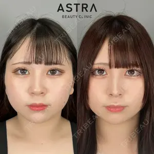 ASTRA BEAUTY CLINIC 塩満 惠子医師の症例