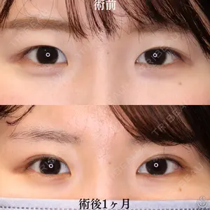 聖心美容クリニック 大阪院 鈴木 雅詞医師の症例