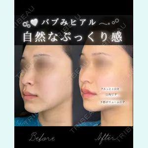 ルラ美容クリニック 大宮院 右京 大季医師の症例